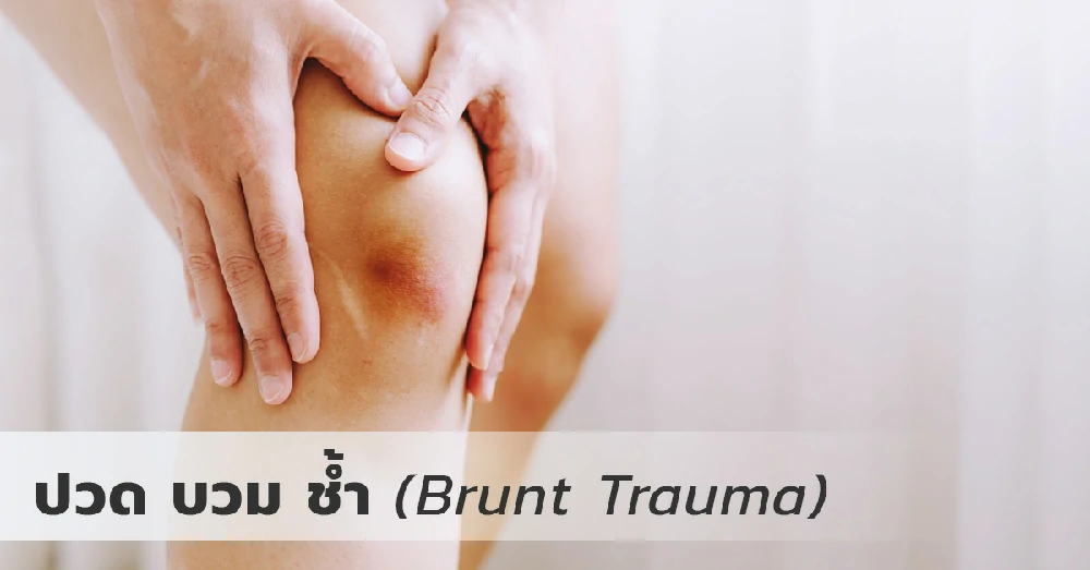 ปวด บวม ช้ำ (Brunt Trauma) คืออะไร? สาเหตุ อาการ และการฟื้นตัวของร่างกาย
