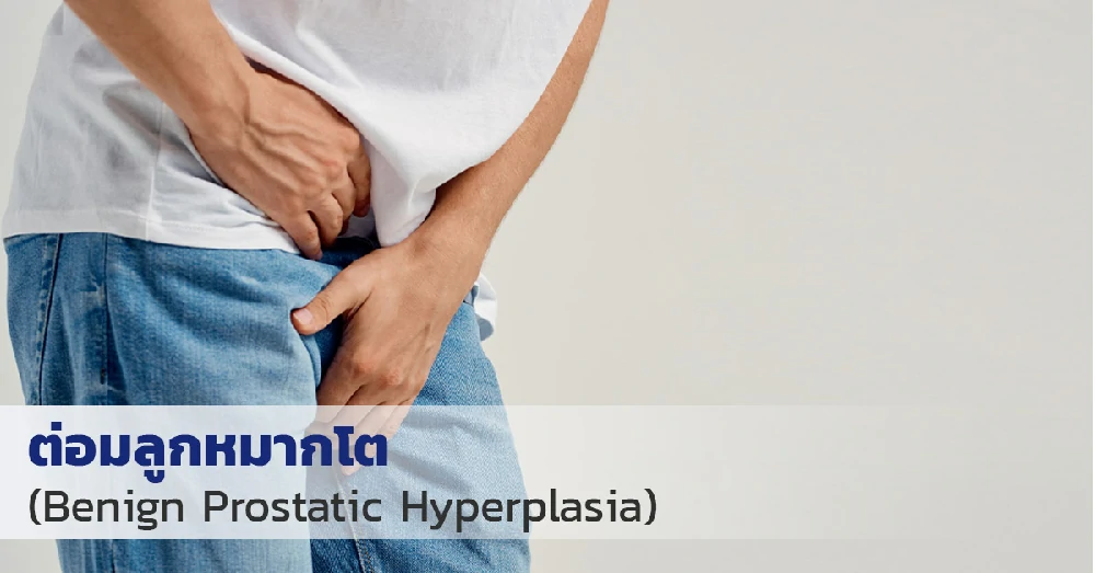 ต่อมลูกหมากโต (Benign Prostatic Hyperplasia) คืออะไร? อันตรายและวิธีป้องกัน